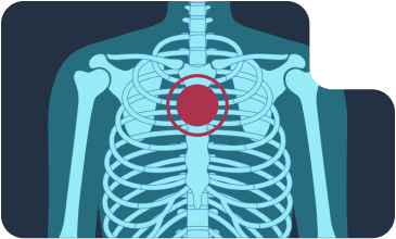 Боль в грудном отделе